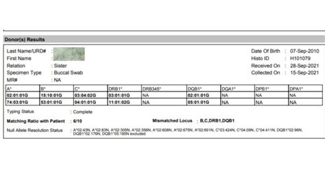 how to read hla test results